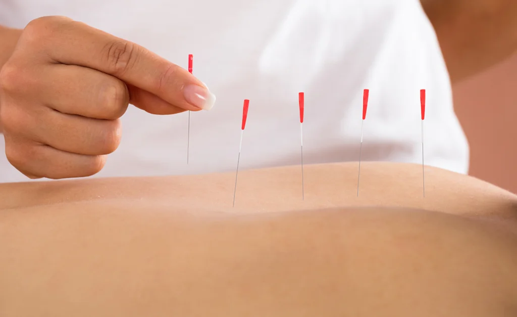 Фармакопунктура